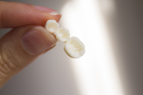 Dental Bridges Vs Implants: Which Option Is Right For You?